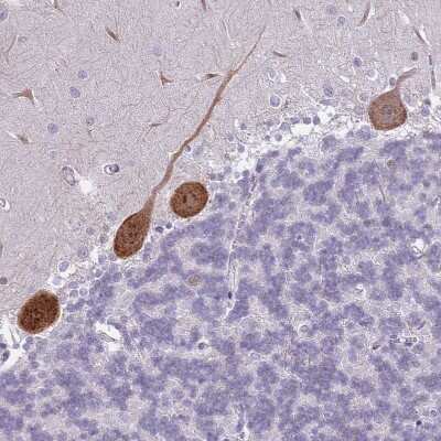 Immunohistochemistry-Paraffin: G-substrate Antibody [NBP2-13800]