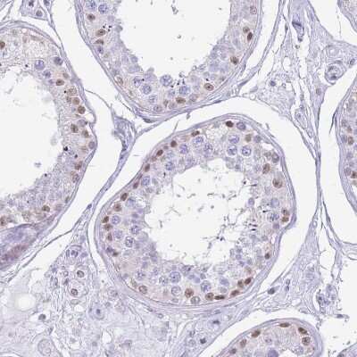 Immunohistochemistry-Paraffin: G-substrate Antibody [NBP2-13800]