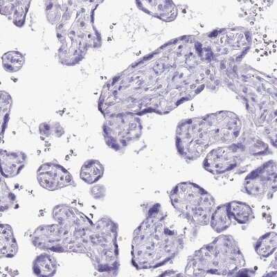 Immunohistochemistry-Paraffin: G-substrate Antibody [NBP2-13800]