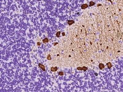 Immunohistochemistry-Paraffin: G-substrate Antibody [NBP2-97480]