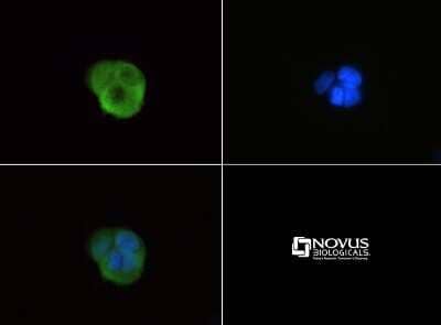 Immunocytochemistry/ Immunofluorescence: G0S2 Antibody [NBP1-71690]