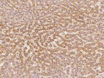 Immunohistochemistry-Paraffin: G0S2 Antibody [NBP3-06188]