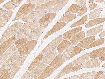 Immunohistochemistry-Paraffin: G0S2 Antibody [NBP3-06188]