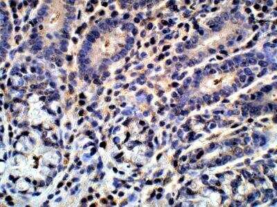 Immunohistochemistry-Paraffin: G0S2 Antibody [NBP3-12396]