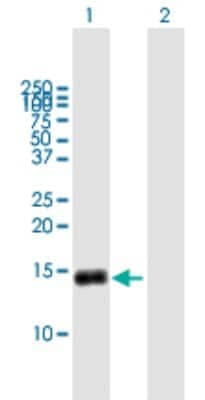 Western Blot: G0S2 Antibody [H00050486-B01P]