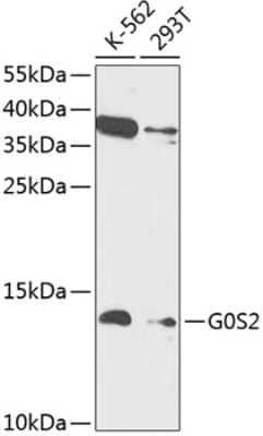 Western Blot: G0S2 AntibodyBSA Free [NBP3-03897]