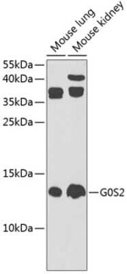 Western Blot: G0S2 AntibodyBSA Free [NBP3-03898]