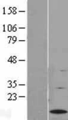 Western Blot: G0S2 Overexpression Lysate [NBL1-10895]