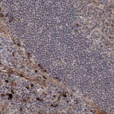 Immunohistochemistry-Paraffin: G2A/GPR132 Antibody [NBP1-89807]