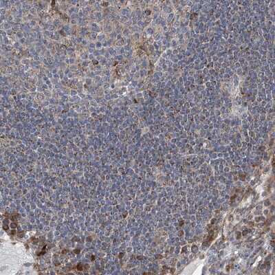 Immunohistochemistry-Paraffin: G2A/GPR132 Antibody [NBP1-89808]