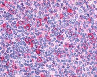 Immunohistochemistry-Paraffin: G2A/GPR132 Antibody - BSA Free [NLS1600]