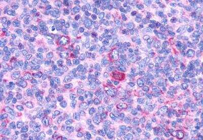 Immunohistochemistry-Paraffin: G2A/GPR132 Antibody - BSA Free [NLS1600]