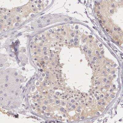 Immunohistochemistry-Paraffin: G2E3 Antibody [NBP1-82184]