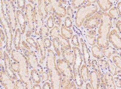 Immunohistochemistry-Paraffin: G2E3 Antibody [NBP3-12582]