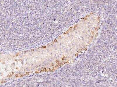 Immunohistochemistry-Paraffin: G2E3 Antibody [NBP3-12582]