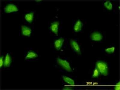 Immunocytochemistry/ Immunofluorescence: G3BP1 Antibody (2F3) [H00010146-M01]