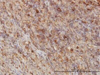 Immunohistochemistry-Paraffin: G3BP1 Antibody (2F3) [H00010146-M01]