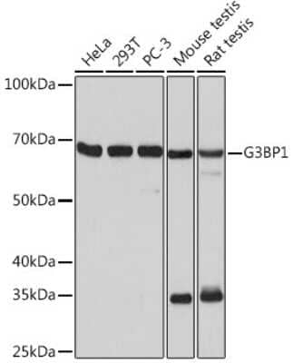 Western Blot: G3BP1 Antibody (5A4T0) [NBP3-16302]