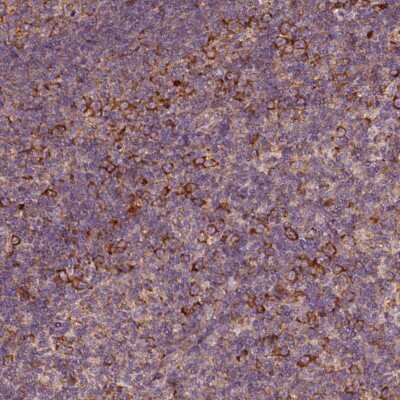 Immunohistochemistry-Paraffin: G3BP1 Antibody [NBP1-83404]