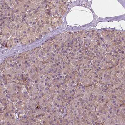 Immunohistochemistry-Paraffin: G3BP1 Antibody [NBP1-83404]