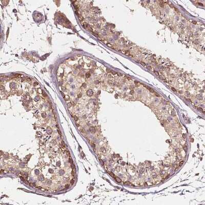 Immunohistochemistry-Paraffin: G3BP1 Antibody [NBP1-83404]