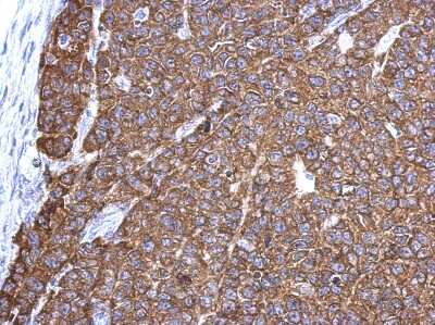 Immunohistochemistry-Paraffin: G3BP1 Antibody [NBP2-16563]
