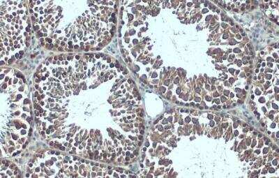 Immunohistochemistry-Paraffin: G3BP1 Antibody [NBP2-16563]