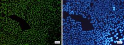 Immunocytochemistry/ Immunofluorescence: G3BP1 Antibody (S09-5B9) [NBP3-15030]