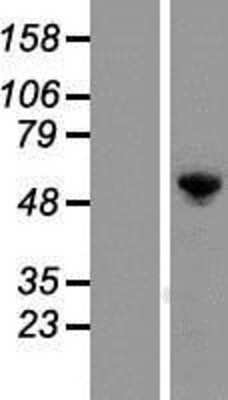 Western Blot: G3BP1 Overexpression Lysate [NBP2-04730]