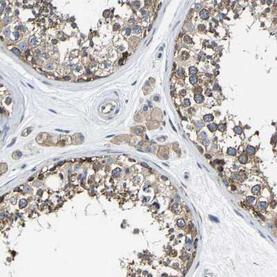 Immunohistochemistry-Paraffin: G3BP2 Antibody [NBP1-82976]