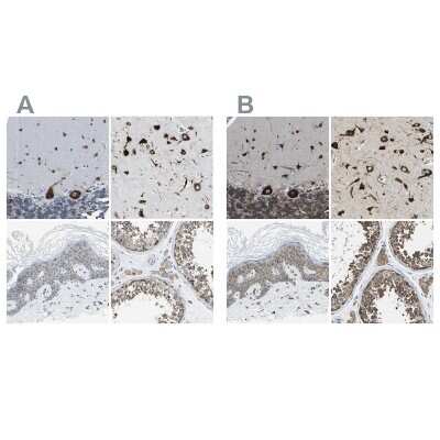 Immunohistochemistry-Paraffin: G3BP2 Antibody [NBP1-82976]