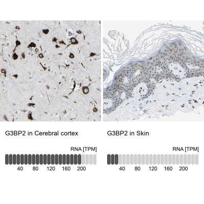 Immunohistochemistry-Paraffin: G3BP2 Antibody [NBP1-82976]