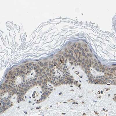 Immunohistochemistry-Paraffin: G3BP2 Antibody [NBP1-82977]