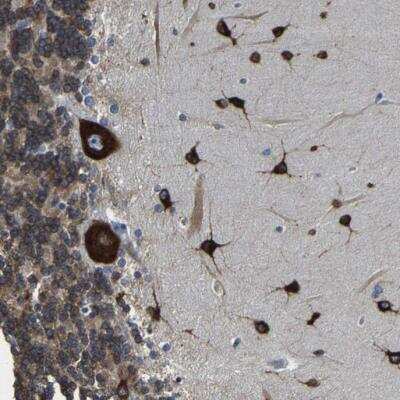 Immunohistochemistry-Paraffin: G3BP2 Antibody [NBP1-82977]