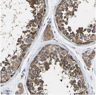 Immunohistochemistry-Paraffin: G3BP2 Antibody [NBP1-82977]