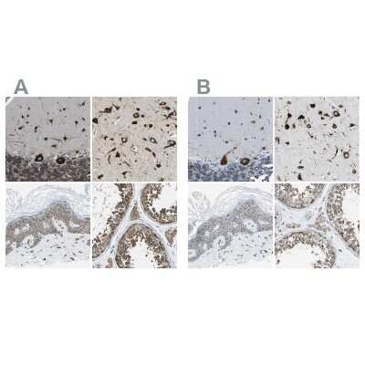 Immunohistochemistry-Paraffin: G3BP2 Antibody [NBP1-82977]
