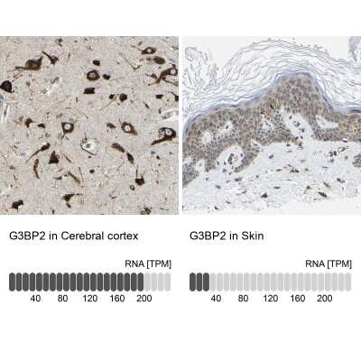 Immunohistochemistry-Paraffin: G3BP2 Antibody [NBP1-82977]