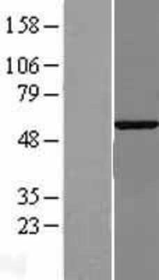 Western Blot: G3BP2 Overexpression Lysate [NBL1-10896]