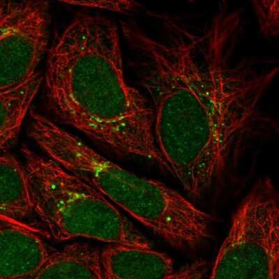 Immunocytochemistry/ Immunofluorescence: G5pr Antibody [NBP2-58168]