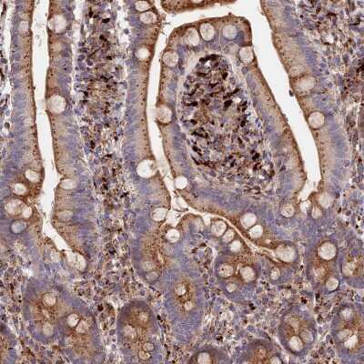 Immunohistochemistry-Paraffin: G5pr Antibody [NBP1-89907]