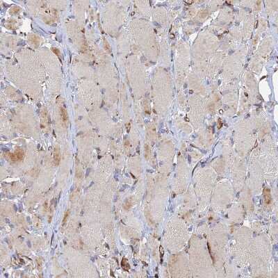 Immunohistochemistry-Paraffin: G5pr Antibody [NBP1-89907]