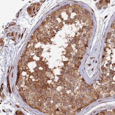 Immunohistochemistry-Paraffin: G5pr Antibody [NBP1-89907]