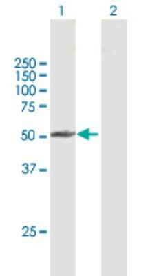 Western Blot: G5pr Antibody [H00055012-B01P]