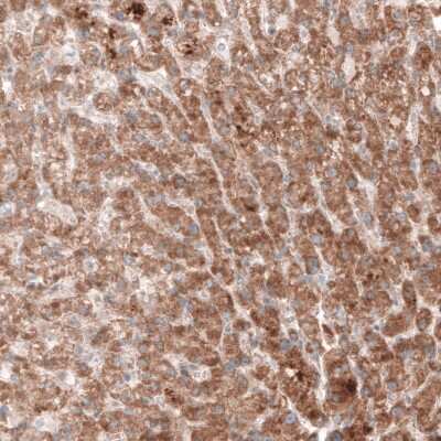 Immunohistochemistry-Paraffin: G6PC Antibody (CL5817) [NBP2-61432]