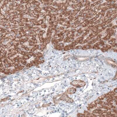 Immunohistochemistry-Paraffin: G6PC Antibody (CL5818) [NBP2-61433]
