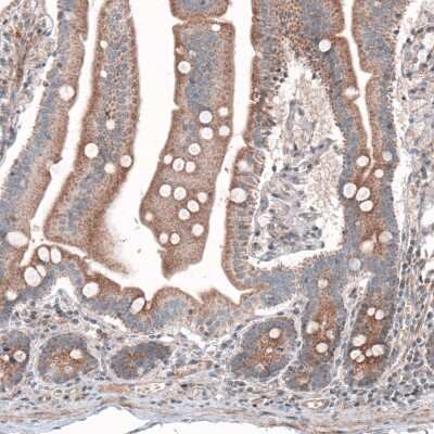 Immunohistochemistry-Paraffin: G6PC Antibody (CL5818) [NBP2-61433]