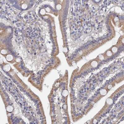Immunohistochemistry-Paraffin: G6PC Antibody [NBP2-31916]
