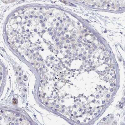 Immunohistochemistry-Paraffin: G6PC Antibody [NBP2-31916]