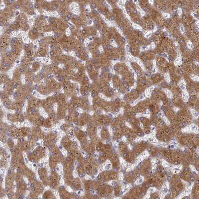 Immunohistochemistry-Paraffin: G6PC Antibody [NBP2-31916]