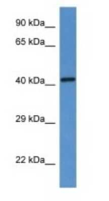 Western Blot: G6PC Antibody [NBP1-80533]